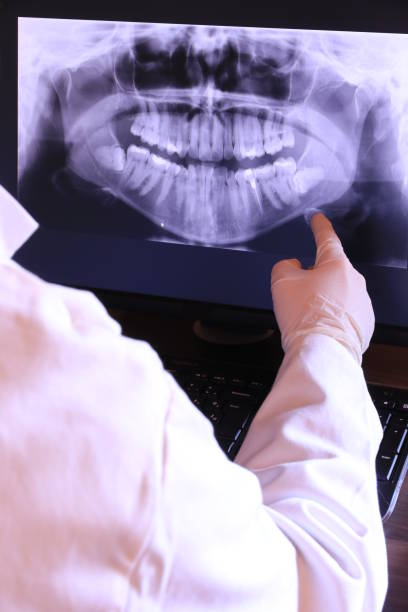 Best Emergency Wisdom Teeth Removal in Punaluu, HI